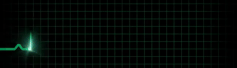 ECG.gif